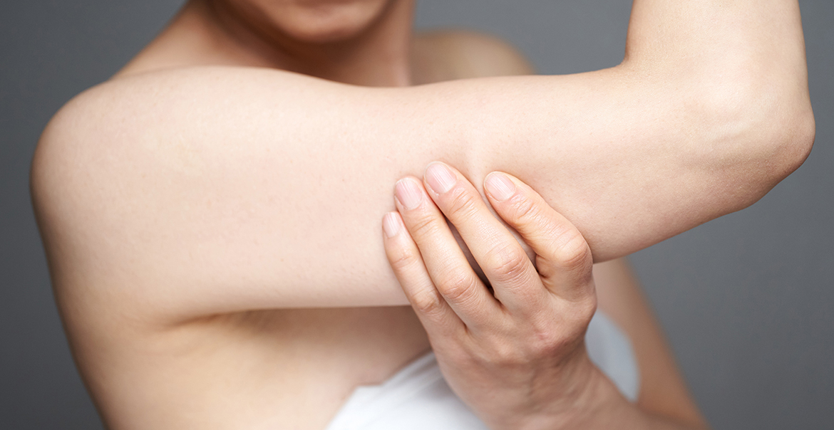 Read more about the article Does CoolSculpting Work on Arms?